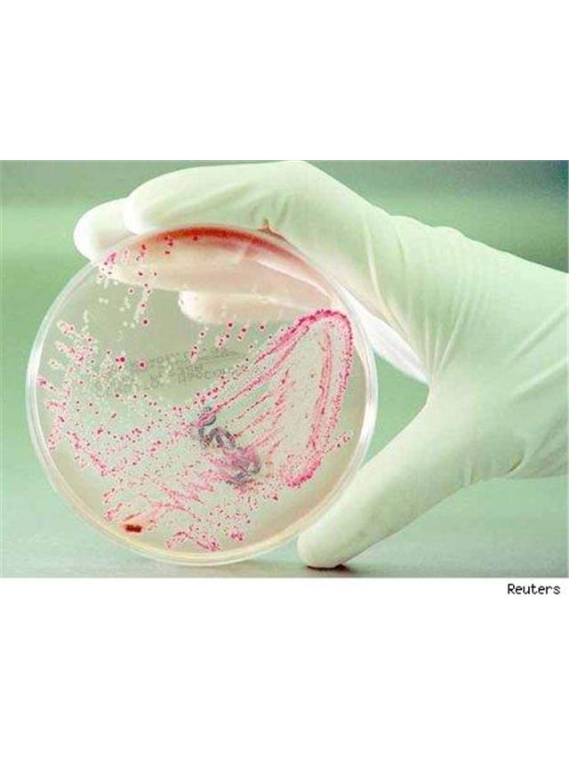 Analiza vode bakterije - E.Coli in Koliformne